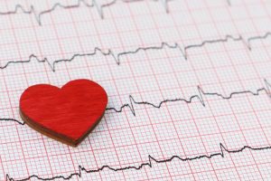 Monitorizarea Holter ECG: când și de ce se face?