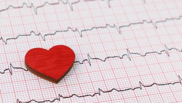 Monitorizarea Holter ECG: când și de ce se face?