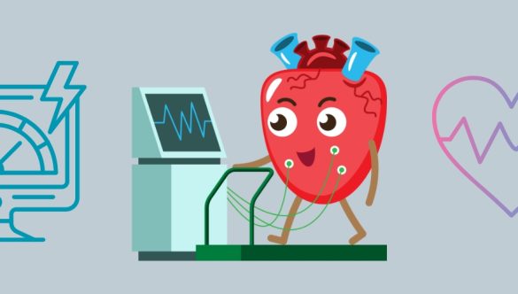 Testul de efort: când este indicat și ce informații oferă