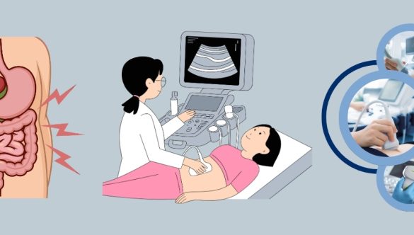 Ecografia abdominală – ce organe evaluează și de ce e utilă anual