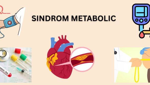 Sindrom cardiometabolic – o problemă complexă cu impact major asupra sănătății